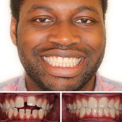 Keith B. Wong, DDS MS - Before and after treatment