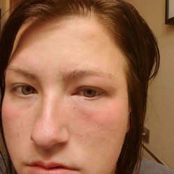 Allergy & Asthma Associates - Awful doctor!! See my review to associate with the photos