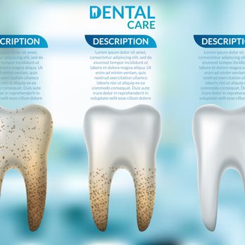 OC Premier Dentistry - Dr Ishani Dhillon Shah, DDS evaluates each patient & recommends a plan for your long term dental care. Get back the Smile you deserve! - General Dentistry Near Me - Aliso Viejo, California OC Premier Dentistry - Dr Ishani Dhillon Shah, DDS evaluates each patient & recommends a plan for your long term dental care. Get back the Smile you deserve! - General Dentistry Near Me - Aliso Viejo, California