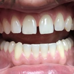 World Dental - Before. - General Dentistry Near Me - Ocala, Florida