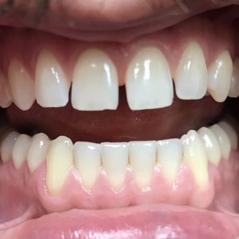 World Dental - Before. - General Dentistry Near Me - Ocala, Florida World Dental - Before. - General Dentistry Near Me - Ocala, Florida