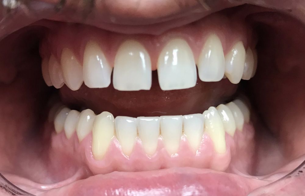 World Dental - Before. - General Dentistry Near Me - Ocala, Florida World Dental - Before. - General Dentistry Near Me - Ocala, Florida