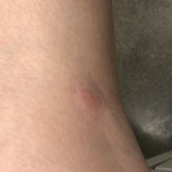 exer urgent care northridge yelp