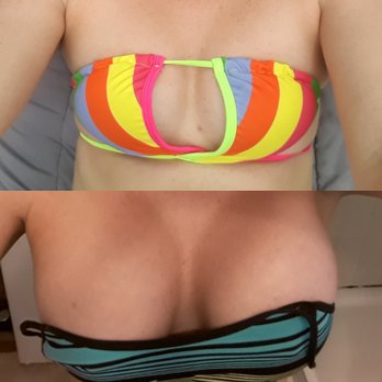 Li Plastic Surgery - Medical Spas Near Me - Ontario, California Li Plastic Surgery - Medical Spas Near Me - Ontario, California