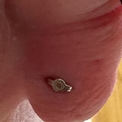 Omni Dermatology - The back of my earring with the skin growing over on the one side