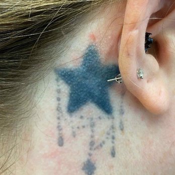 Vanish Laser Services - Beginning #1 - Tattoo Removal Near Me - Pensacola, Florida Vanish Laser Services - Beginning #1 - Tattoo Removal Near Me - Pensacola, Florida