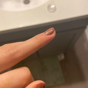 Cambridge Nails and Skin Spa - My finger started to have bad inflammation the next day after manicure.... it is still swollen and hurts a lot - Skin Care Near Me - Cambridge, Massachusetts