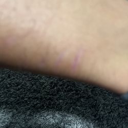 Corewell Health Beaumont - Thats the scratch now because it happened September first