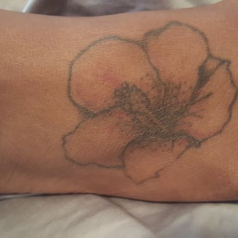 Detroit's Custom 5150 Ink - Niece's tat before. - Tattoo Near Me - Detroit, Michigan