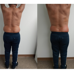 Perfect Touch Body Contouring - Before / After