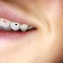 Photo of Bay Area Tooth Gems