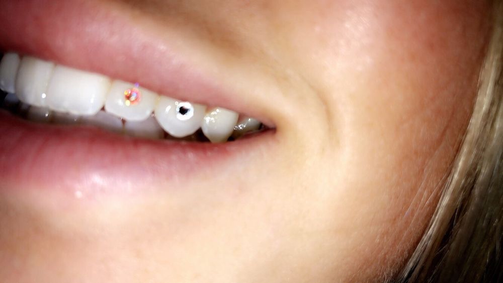 Bay Area Tooth Gems Logo
