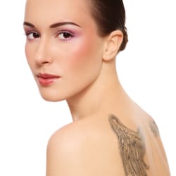The Angel Laser Clinic - Laser Tattoo removal