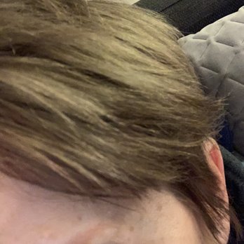 EverTrue Microblading Salon - 3 years later. Some hair permanently gone. Orange shadow. So bad. - Permanent Makeup Near Me - Chicago, Illinois EverTrue Microblading Salon - 3 years later. Some hair permanently gone. Orange shadow. So bad. - Permanent Makeup Near Me - Chicago, Illinois
