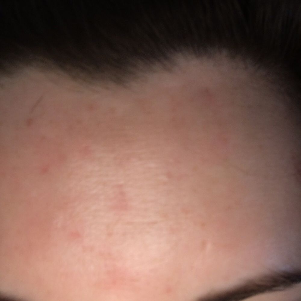 Fine Lines - Permanent Makeup Near Me - Peoria, Arizona