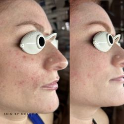 Skin By Molly M