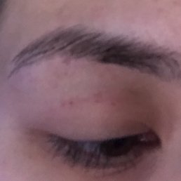 Uneven tail & a cut on my eyelid :/ Uneven tail & a cut on my eyelid :/