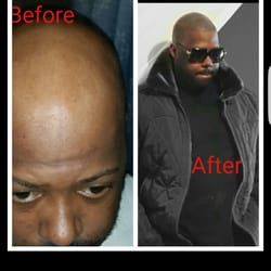 Baltimore Scalp Pigmentation - Baltimore scalp pigmentation change my life. Without the help of Bill and his staff I would still be wearing a hat. Thanks for all you done.