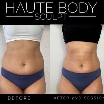 Haute Body Sculpt - Body Contouring Near Me Haute Body Sculpt - Body Contouring Near Me