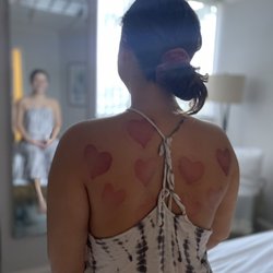 Tranquility Massage & Thai Healing Spa - Cupping Therapy *Alleviate symptoms by promoting blood circulation and improving immunity while experiencing a deep tissue release