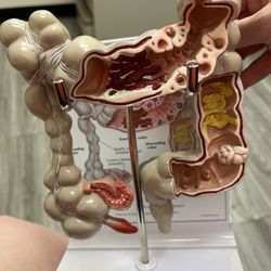 Desert Gastroenterology Associates - Colon display