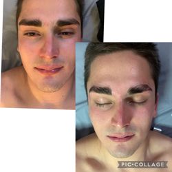 Esthetics By Amber - Before and after facial