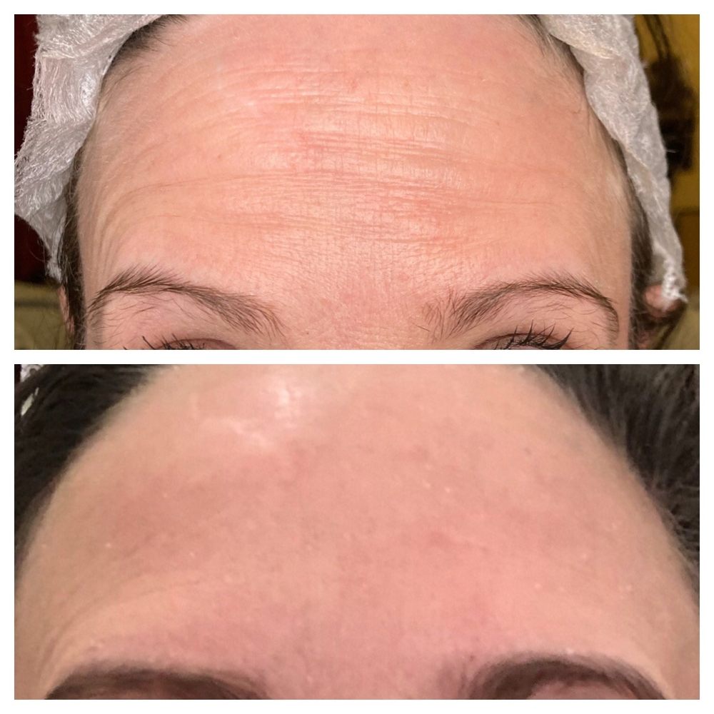 BELLISIMA BEAUTY MEDI SPA Updated June 2024 10 Photos 1148 E Tremont Ave, Bronx, New York