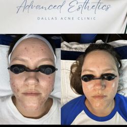 Advanced Esthetics of Richardson - Real Clients! Real Results!