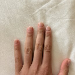My left hand with normal looking cuticles My left hand with normal looking cuticles