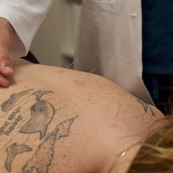 Tampa Heights Acupuncture - Acupuncture