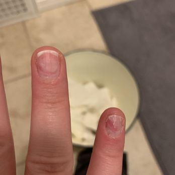 Gina's Magic Nails - My poor pinky nail that was filed down so much it hurts to touch :( - Nail Salons Near Me - Chicago, Illinois