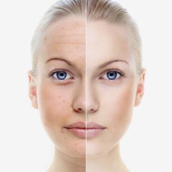 Zen Med Spa - Microneedling and Facial - Medical Spas Near Me - Hinsdale, Illinois Zen Med Spa - Microneedling and Facial - Medical Spas Near Me - Hinsdale, Illinois