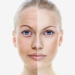 Zen Med Spa - Microneedling and Facial