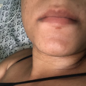 The Wax Strip - Underneath lip scratch as well - Waxing Near Me - Jacksonville, Florida