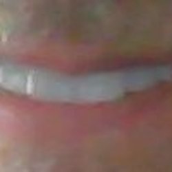 Dr. James Schulte, the best dentist period.