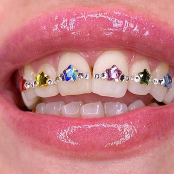 ToothGems 1985 - Rainbow stars just in. Text us to book! - Cosmetic Dentists Near Me - West Hollywood, California ToothGems 1985 - Rainbow stars just in. Text us to book! - Cosmetic Dentists Near Me - West Hollywood, California