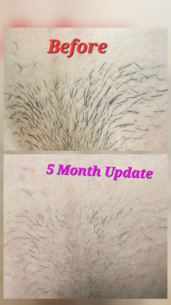 The Sweet Spot Med Spa & Electrolysis Logo