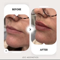 JCC Aesthetics