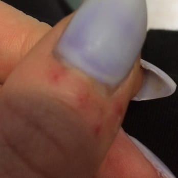 DB Nails and Spa - A look at the botched job on my nails! - Nail Salons Near Me - Lubbock, Texas