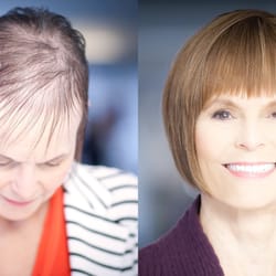 P K Salon - PK Salon offers the EVOLVE Volumizer as a solution to Hair Loss and Thinning Hair