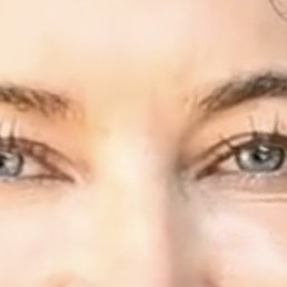 Before with Hooded Lids Before with Hooded Lids