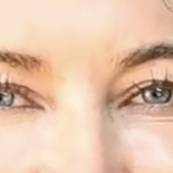 Mehryar Ray Taban, MD - Before with Hooded Lids - Ophthalmologists Near Me - Beverly Hills, California Mehryar Ray Taban, MD - Before with Hooded Lids - Ophthalmologists Near Me - Beverly Hills, California