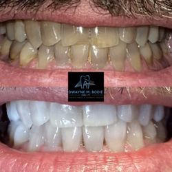 Dwayne M Bodie DMD PC - The only teeth whitening product that delivers this result!