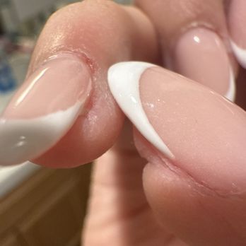 Pierpont Nail Spa - Drilled skin burns - Nail Salons Near Me - Ventura, California