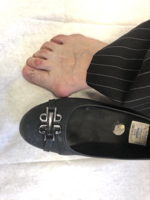 GLENN PFEFFER, MD - CEDARS SINAI ORTHOPEDIC CENTER - Updated March 2026 ...