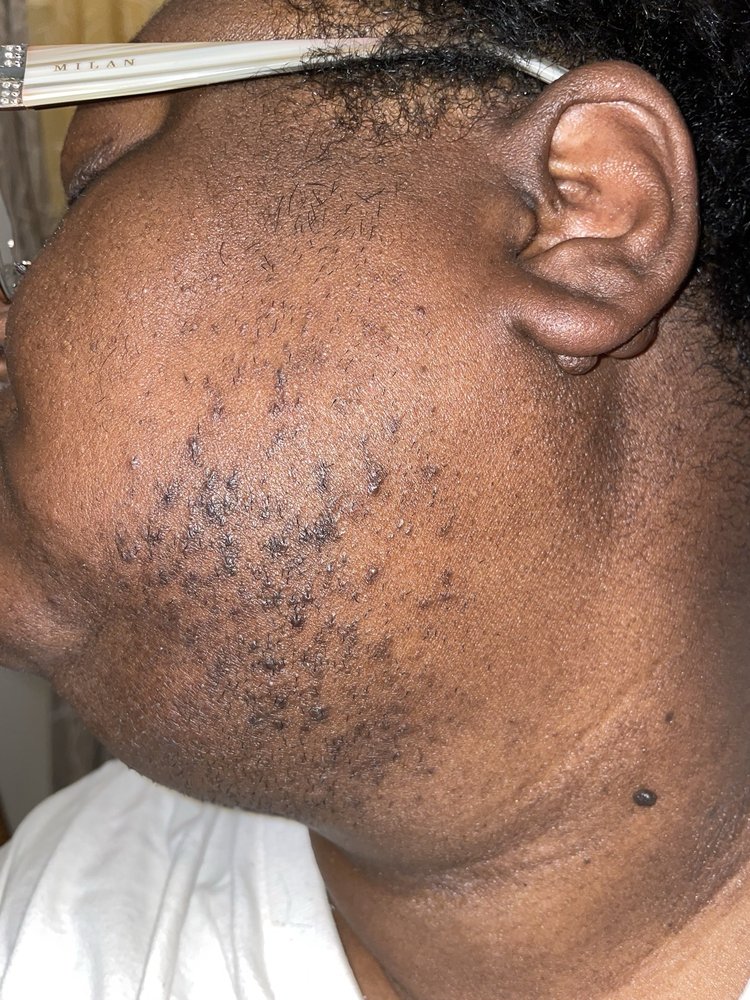 Fort Worth Electrolysis Logo