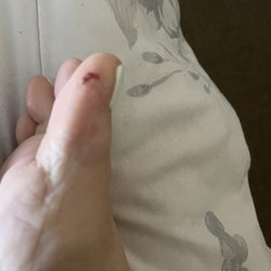 Perfect Nails - The cut on my toe from the pedicure