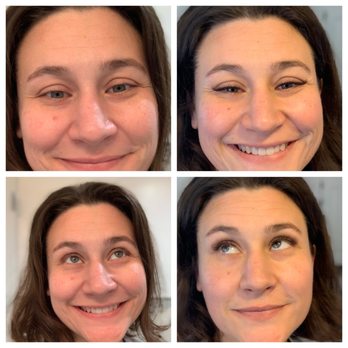 Amazing Lash Studio - Before and after - Eyelash Service Near Me - Overland Park, Kansas