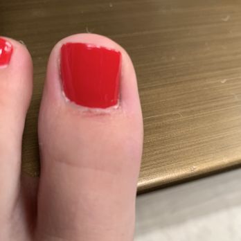 Ace Nail Shop - The cut she left on my big toe!!! - Nail Salons Near Me - Mill Valley, California Ace Nail Shop - The cut she left on my big toe!!! - Nail Salons Near Me - Mill Valley, California