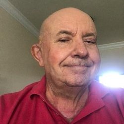 Center for Custom Prosthetics - The lower (lobe) half of my ear is real, the upper part is silicone created by the Center. As you can see, you can't tell the difference!